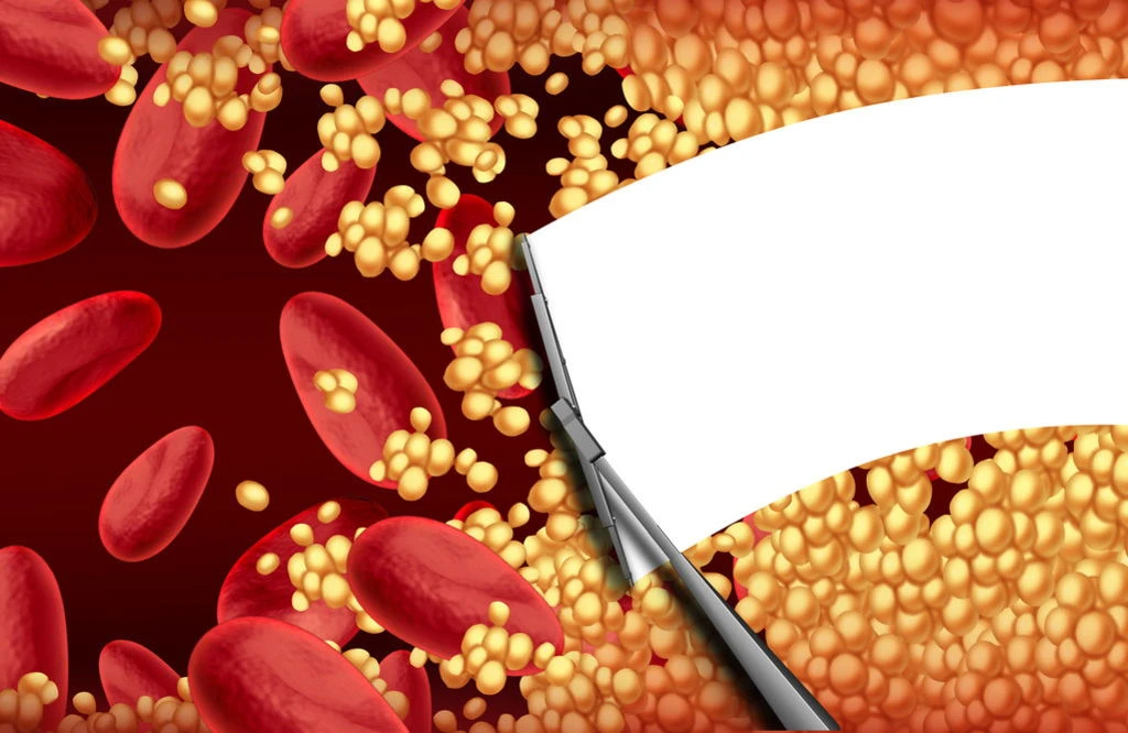 The blood lipid-lowering effect of Betulin extraction powder